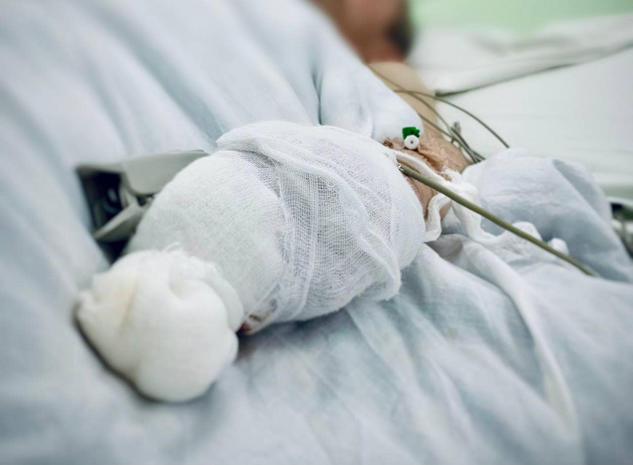 17 людей з обмороженнями госпіталізували на Львівщині: як уберегтися