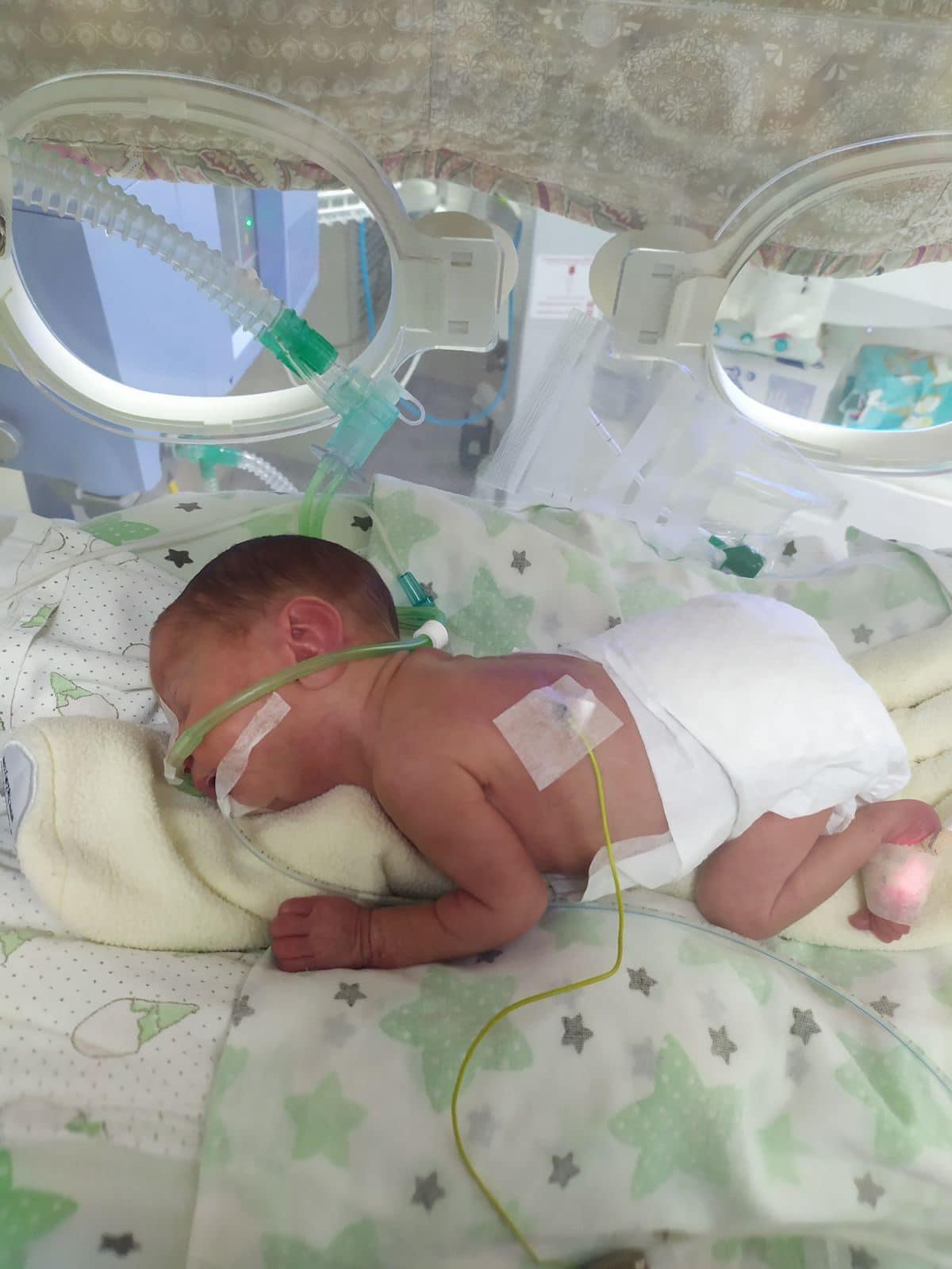 Львівські лікарі виходили передчасно народжене немовля з вагою менше кілограма