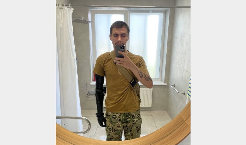 У Львові Захиснику виготовили і встановили протез із електронним ліктем