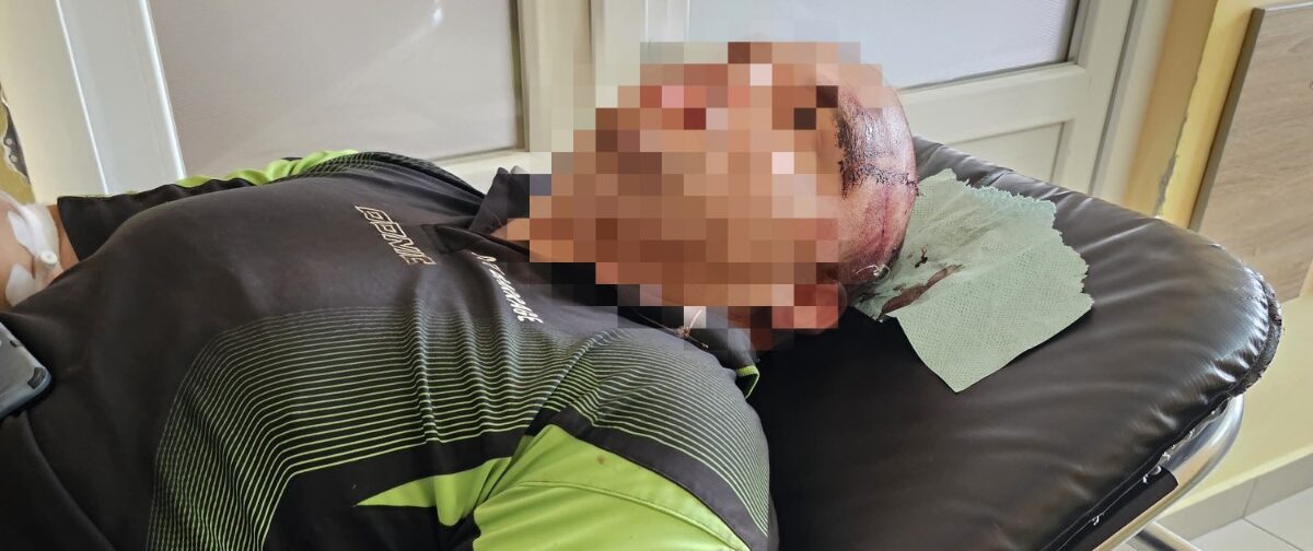 На Львівщині знайшли покаліченого киянина, який вистрибнув з потяга, щоб незаконно перетнути кордон