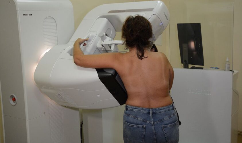 У липні жінок з Львівської громади запрошують зробити мамографію: графік обстежень