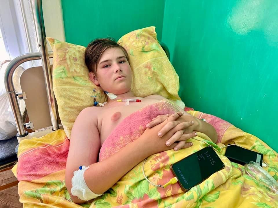 Львівські лікарі вилікували 16-річного хлопця з травмами після падіння велосипеда