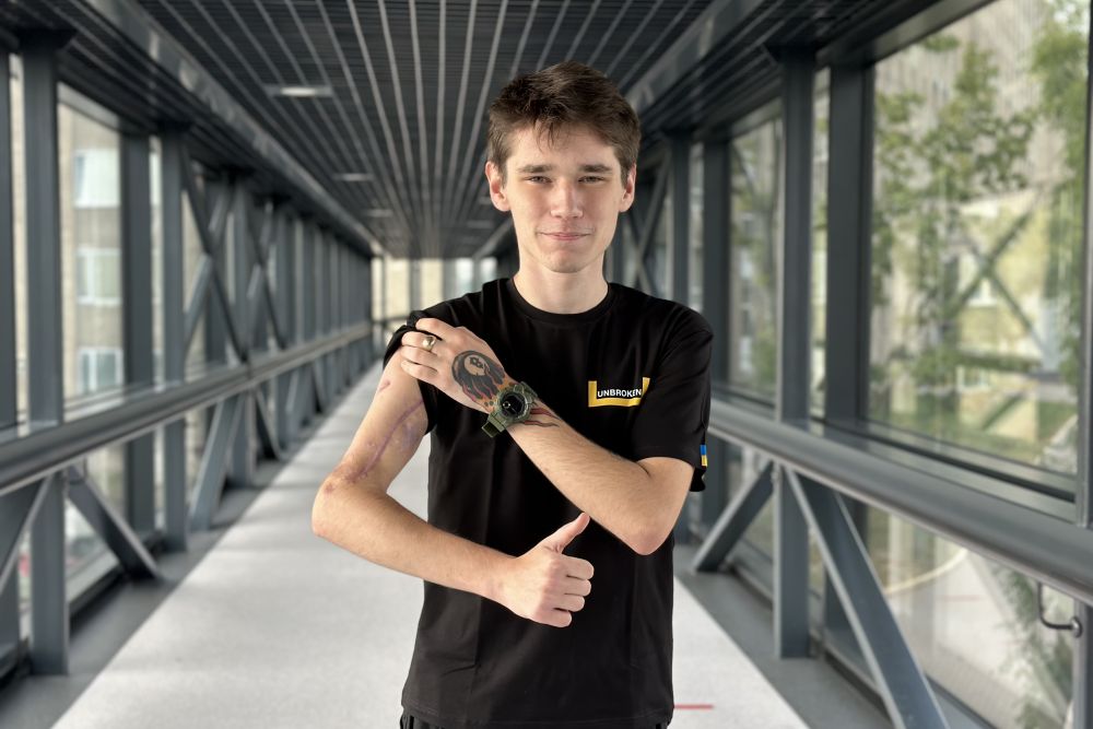 У Львові хірурги врятували руку військовому, що рік був у полоні