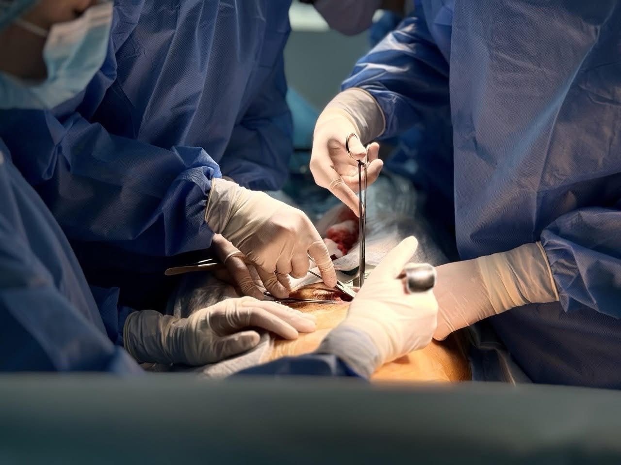 У Львові провели третю трансплантацію нирки 21-річній пацієнтці