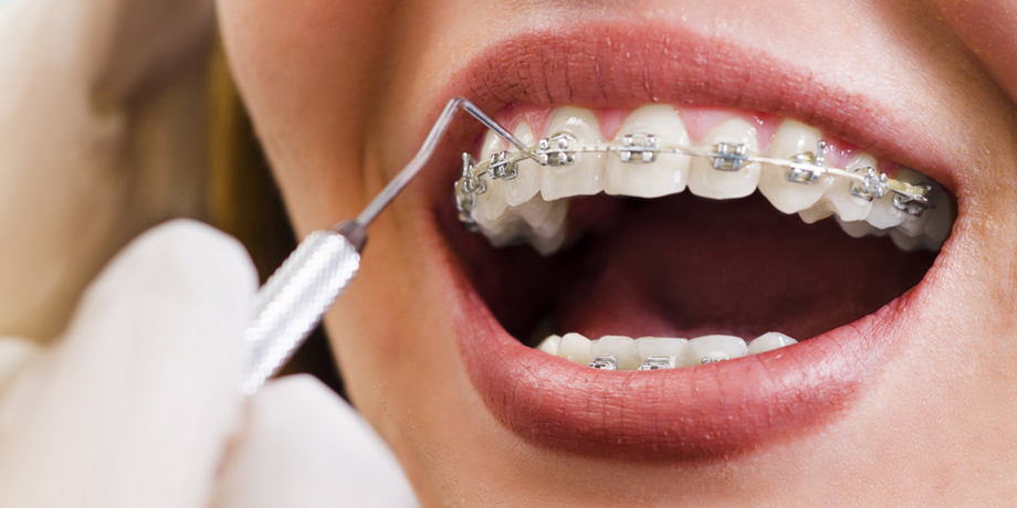 Маленьких пацієнтів з розщілинами губи і піднебіння консультуватиме американська ортодонтка: як потрапити на прийом