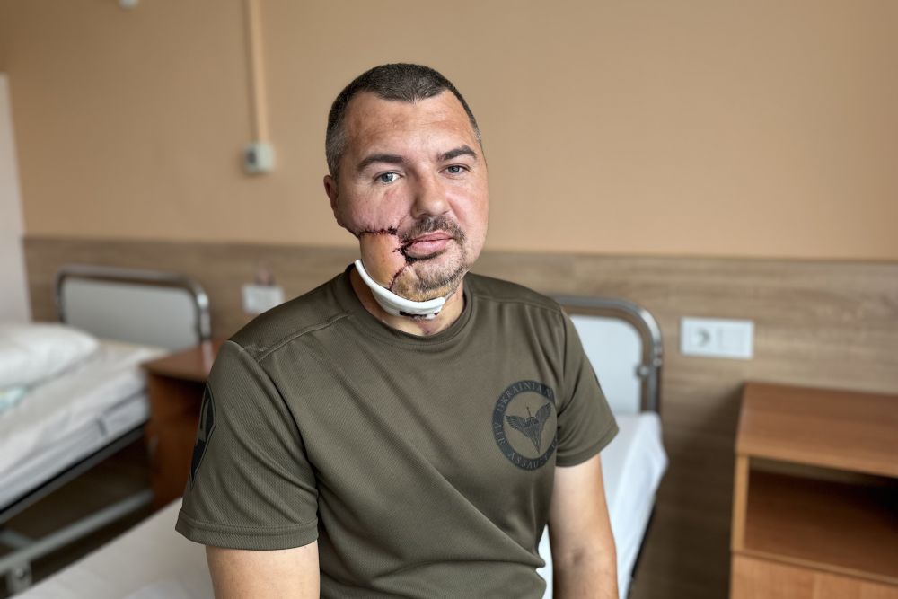 Львівські хірурги реконструювали 39-річному Захиснику понівечене уламками обличчя