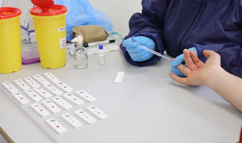 За 9 місяців 2024 року на Львівщині виявлено 115 позитивних результатів на ВІЛ-інфекцію