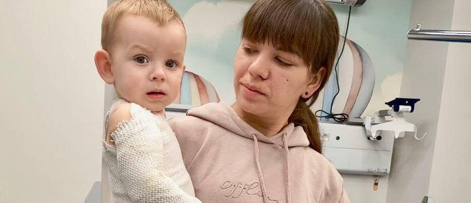 Перекинув чайник з окропом: у Львові медики успішно виходили 11-місячне немовля із сильними опіками