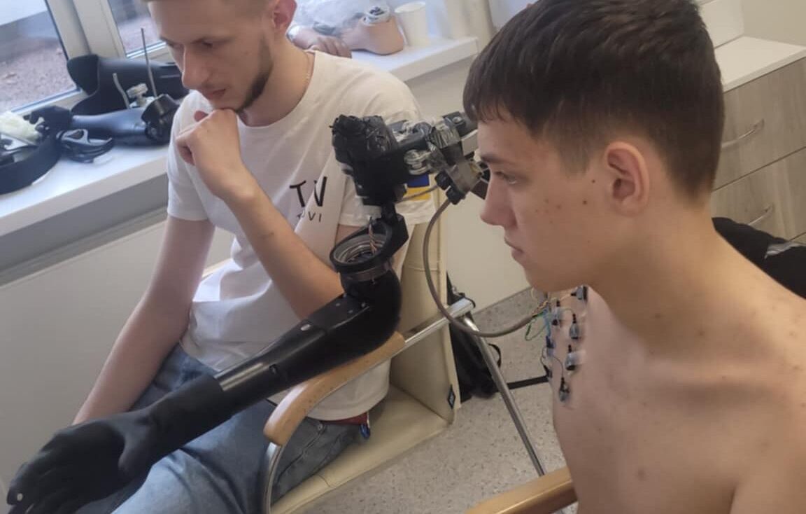 14-річний Артем Лесик з Самбірщини, який втратив руку у ДТП, отримає біонічний протез у центрі TYTANOVI