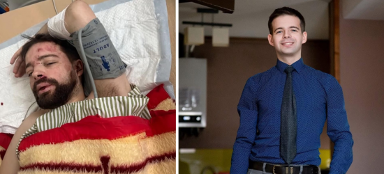 “Вистрибнув із кузова автомобіля”: інцидент із побитим лаборантом ЛНУ імені Івана Франка прокоментували у поліції