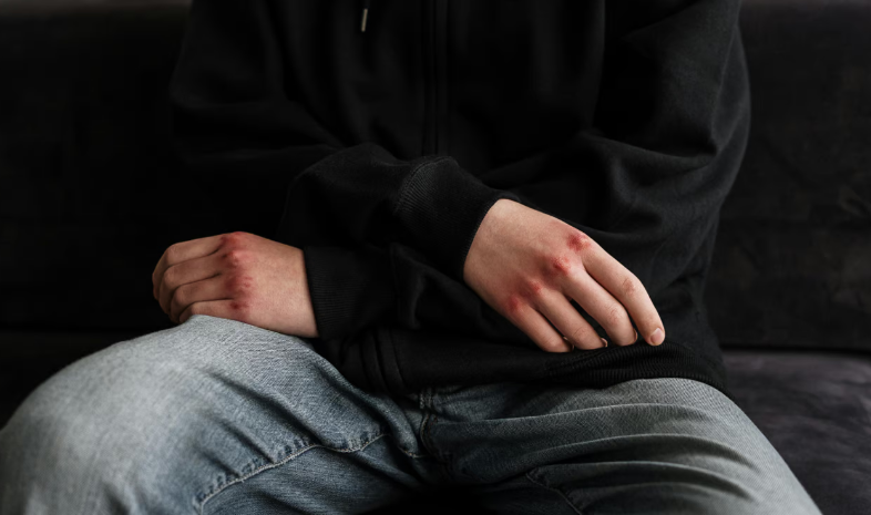 Поліцейські встановили підлітків, причетних до вчинення хуліганських дій, відносно хлопця з інвалідністю у Трускавці