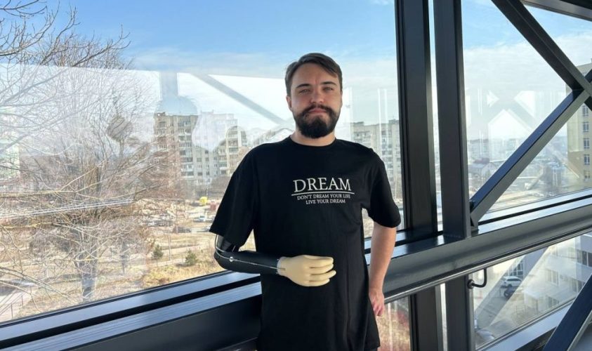 Захисник, який втратив руку на фронті, готується до протезування у Львові