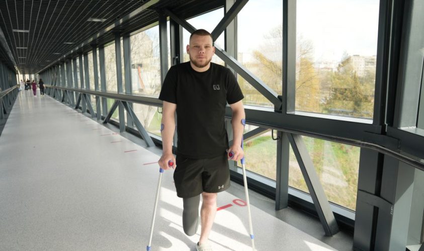 У центрі UNBROKEN готується до протезування воїн, який втратив на війні ногу