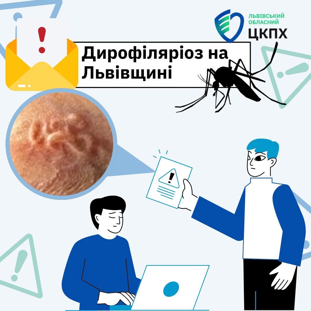 На Львівщині з ноги чоловіка витягнули 11-сантиметрового паразита: деталі