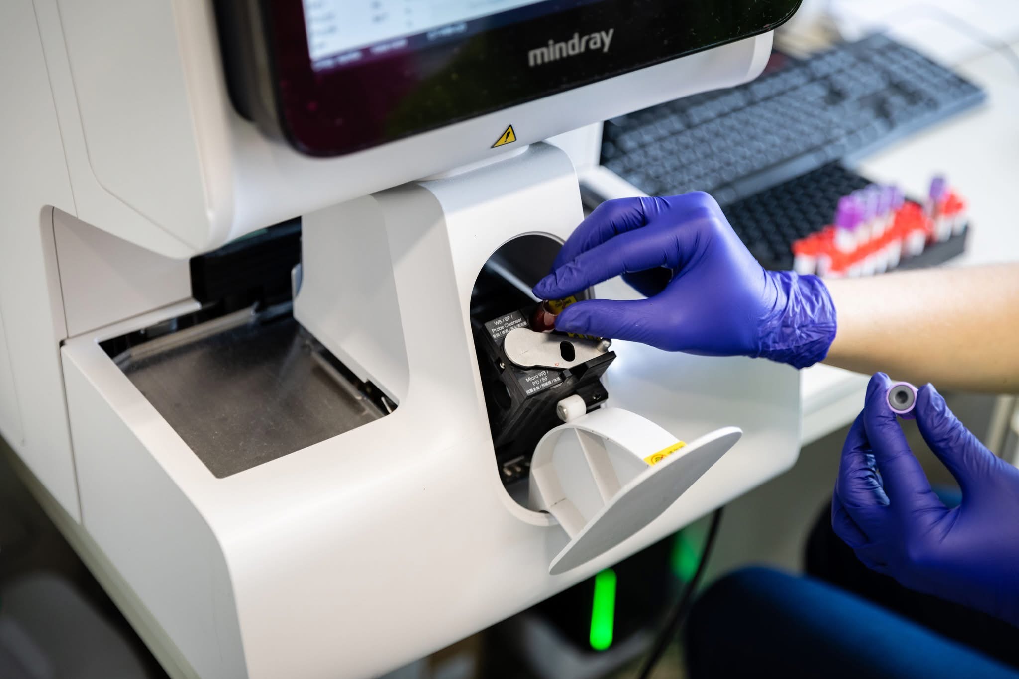 На Львівщині стартував збір для дітей, які борються з раком: як долучитися