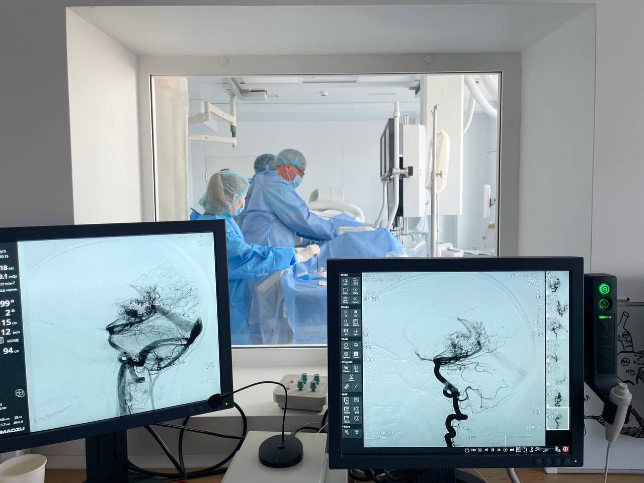 У Львові відомий угорський нейрохірург прооперував підлітка з рідкісною патологією судин мозку