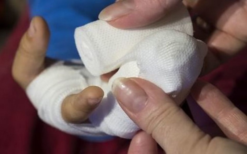Чоловіку відірвало руку на Львівщині – вибухнув невідомий предмет біля його дому
