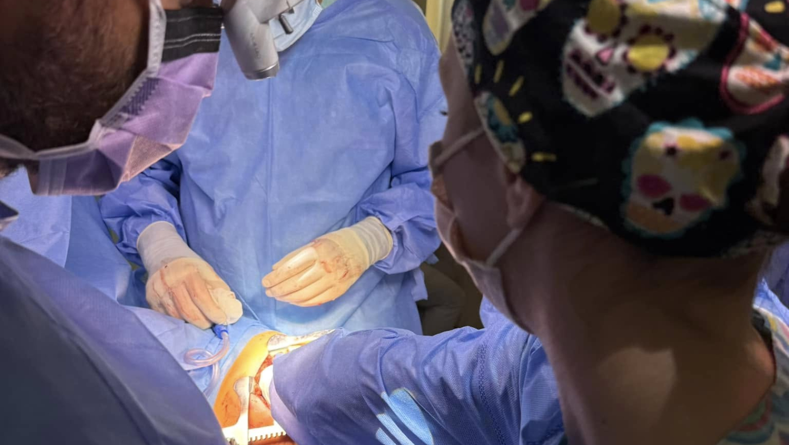 Проковтнув ковпачок від ручки: дитині провели відкриту операцію на грудній клітці