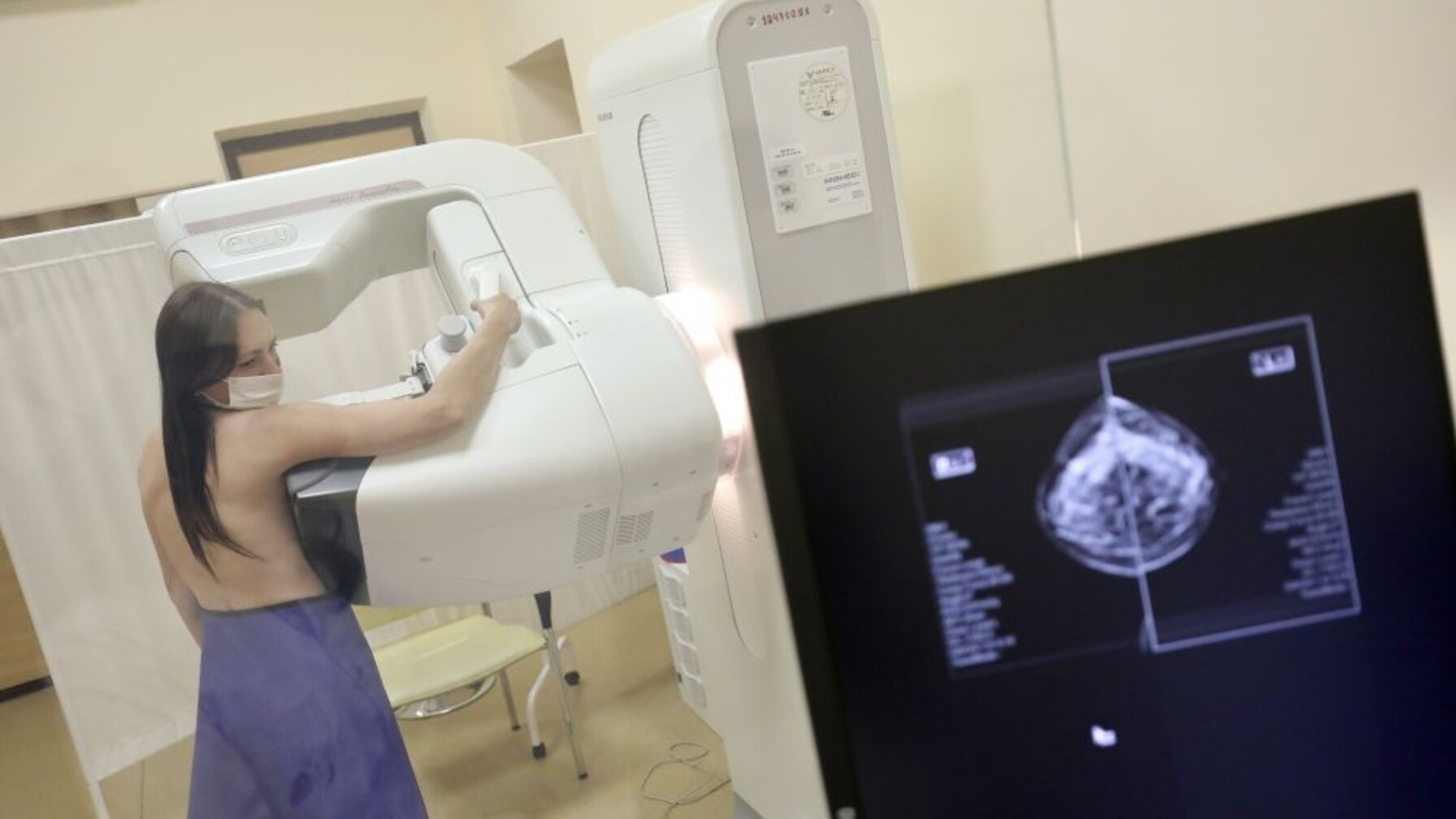 Жінок Львівської громади кличуть на безкоштовну мамографію у вихідний