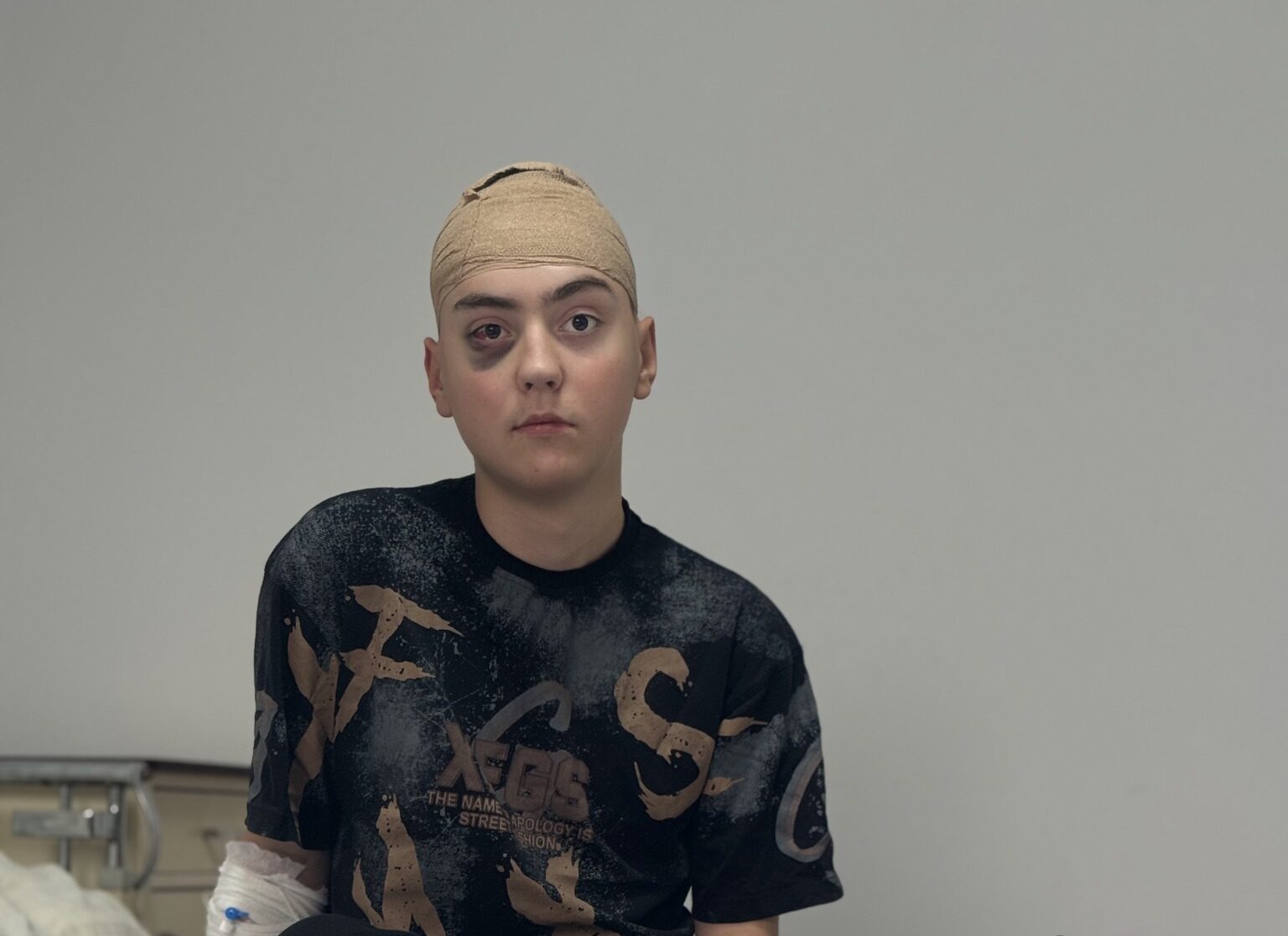 Львівські нейрохірурги вдруге врятували 17-річного підлітка з рідкісною пухлиною мозку