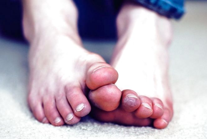 Ледь не замерз насмерть: 67-річного жителя Козьової у критичному стані доправили в реанімацію