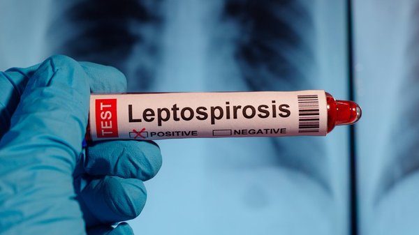 Від лептоспірозу помер 69-річний мешканець Львівщини
