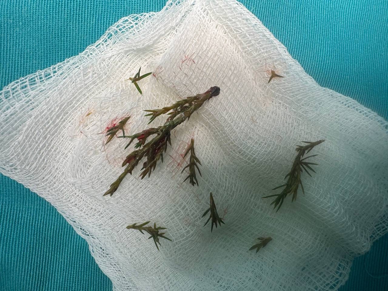 У Львові медики врятували 8-місячного малюка, який ледь не задихнувся гілочками ялинки