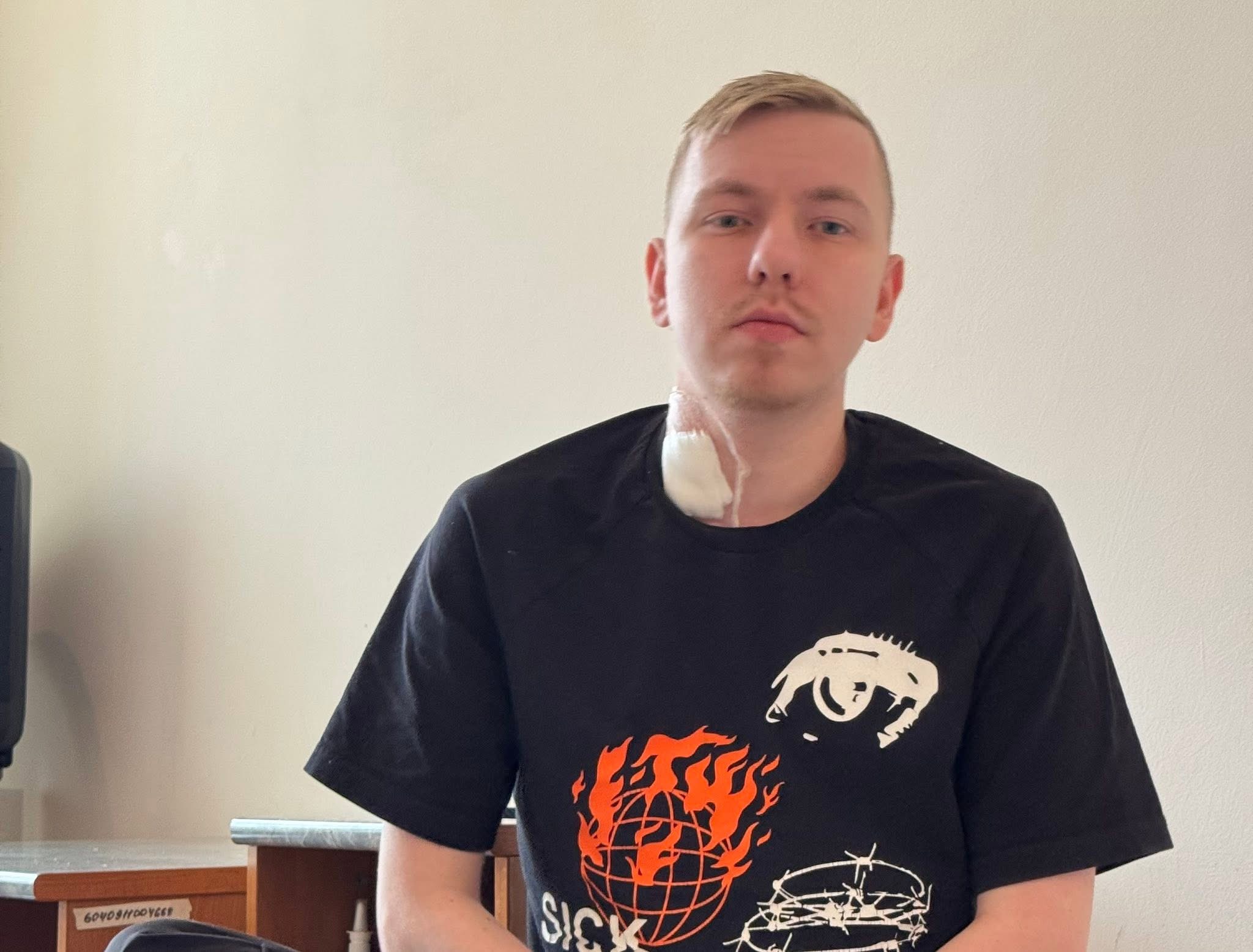 23-річний чоловік потрапив до реанімації у Львові через ускладнення від грипу