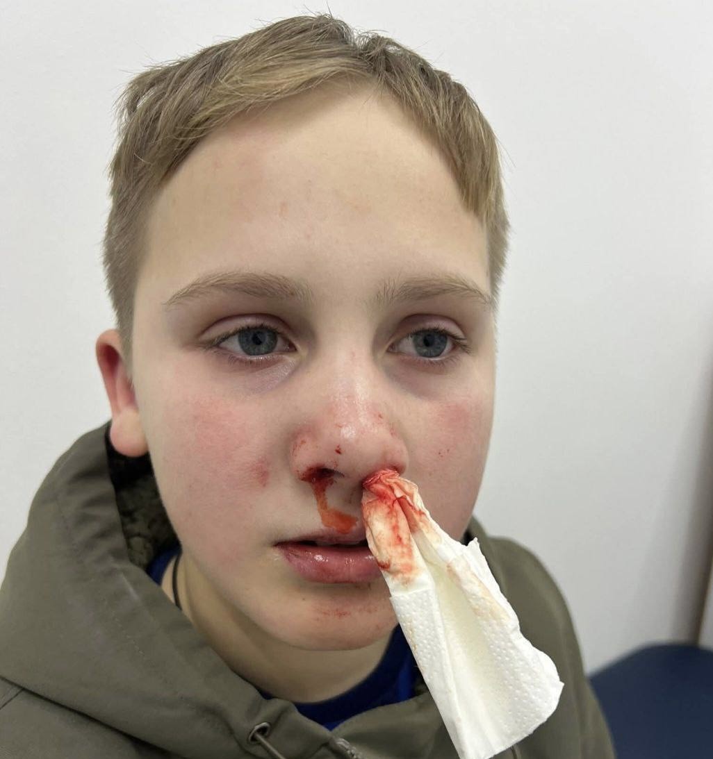 Поліція встановила чоловіка, який напав на 11-річного школяра під час катання на санчатах у Львові