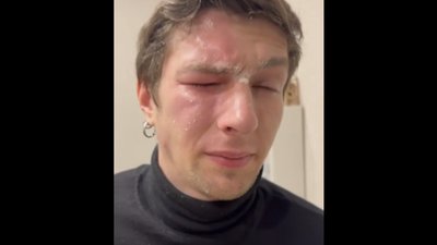 У Львові жінка розпилила газовий балончик в обличчя ветерану