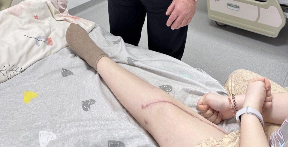 Перелом через пухлину: львівські лікарі зберегли ногу 16-річній дівчину з агресивною формою раку