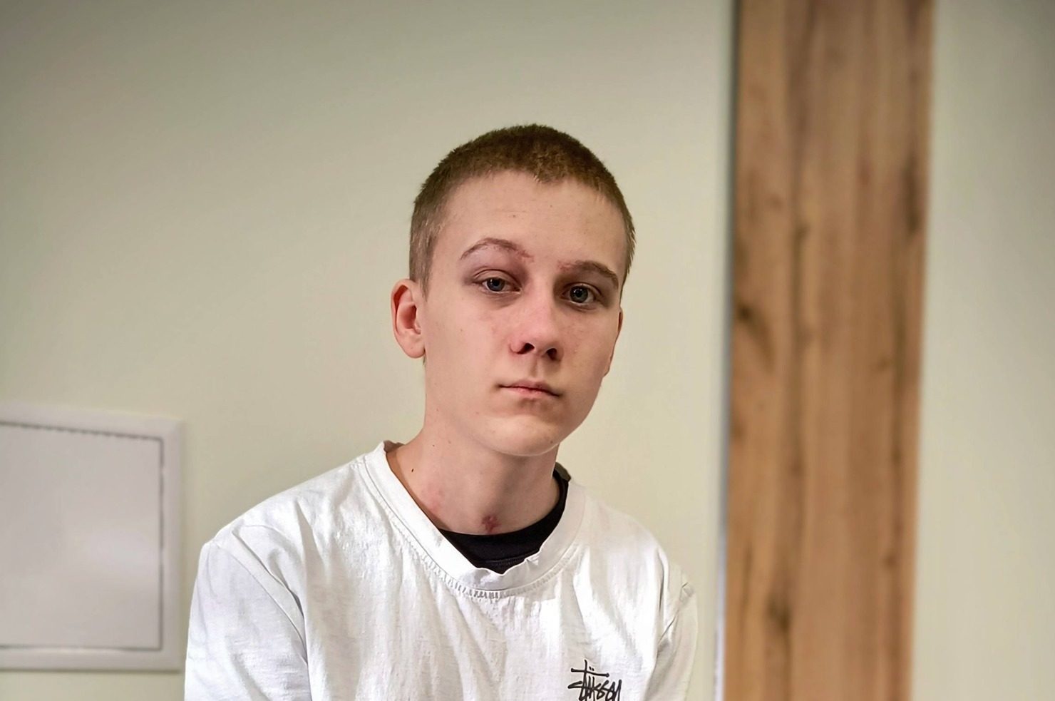 Впав у кому після свого 16-річчя: львівські лікарі врятували хлопця від гнійного ураження мозку