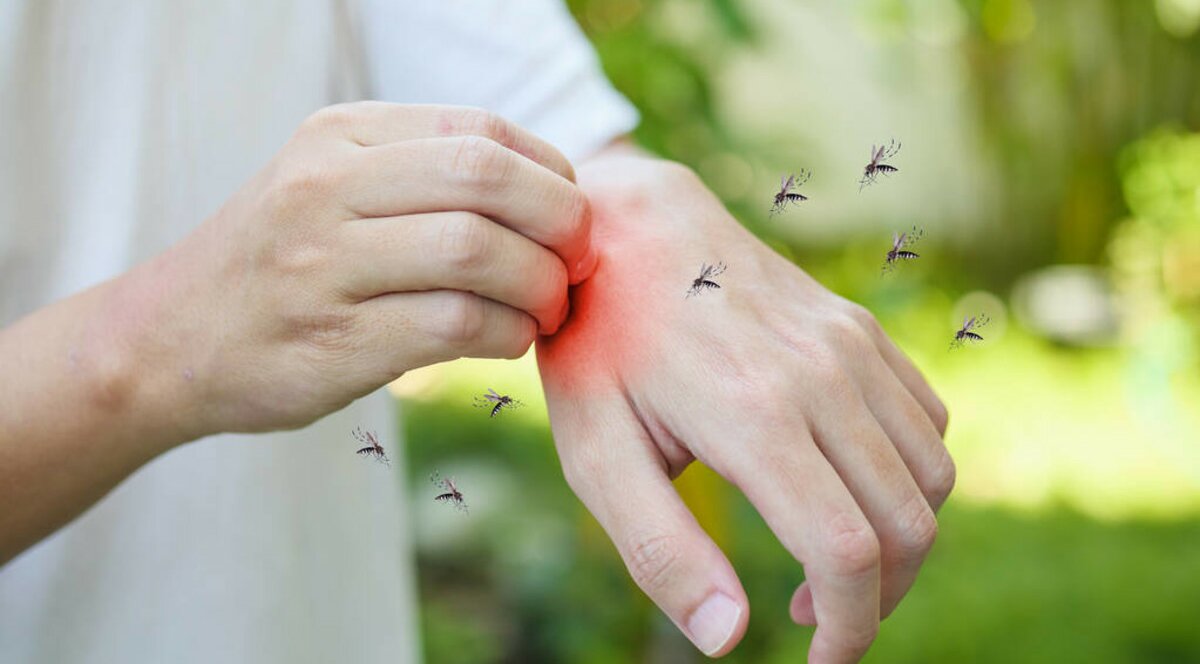 Екзотична відпустка — з небезпечним “сувеніром”: у Львові вдруге за три місяці виявили гарячку Денге