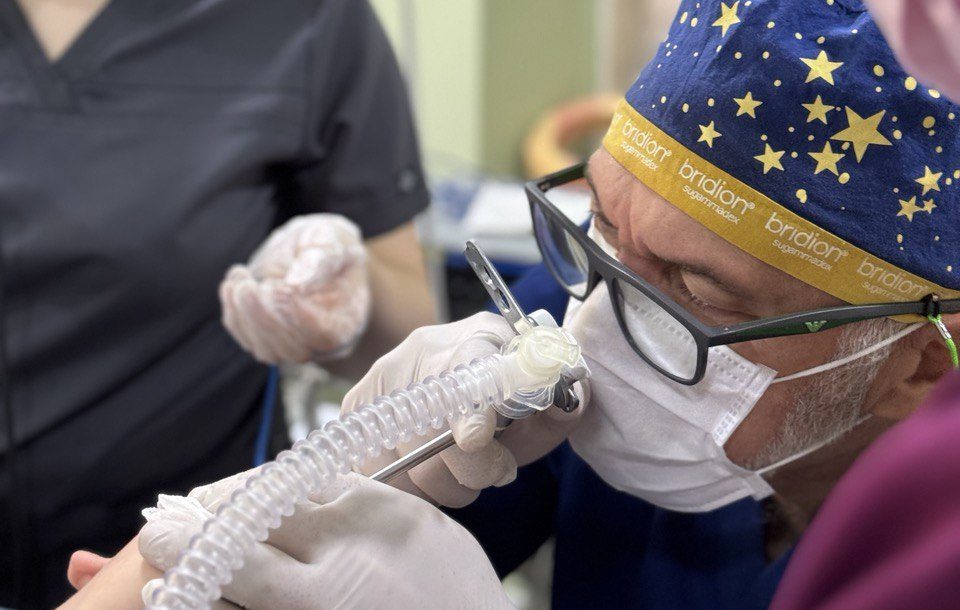 Два роки боротьби за можливість їсти: львівські хірурги врятували 3-річну дитину після хімічного опіку стравоходу