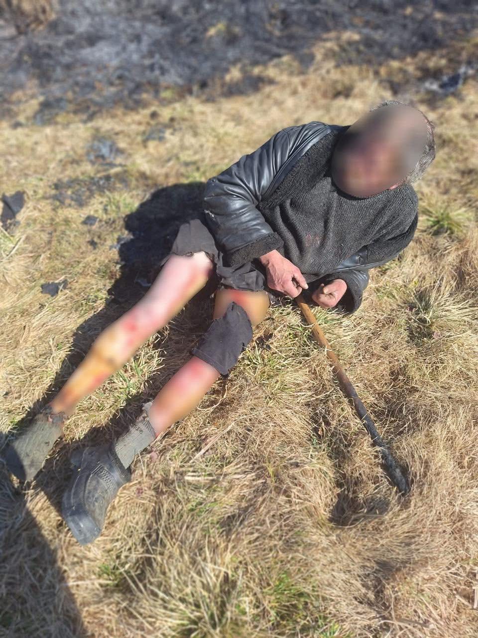 У львівській лікарні за один день померли троє людей через підпал сухої трави