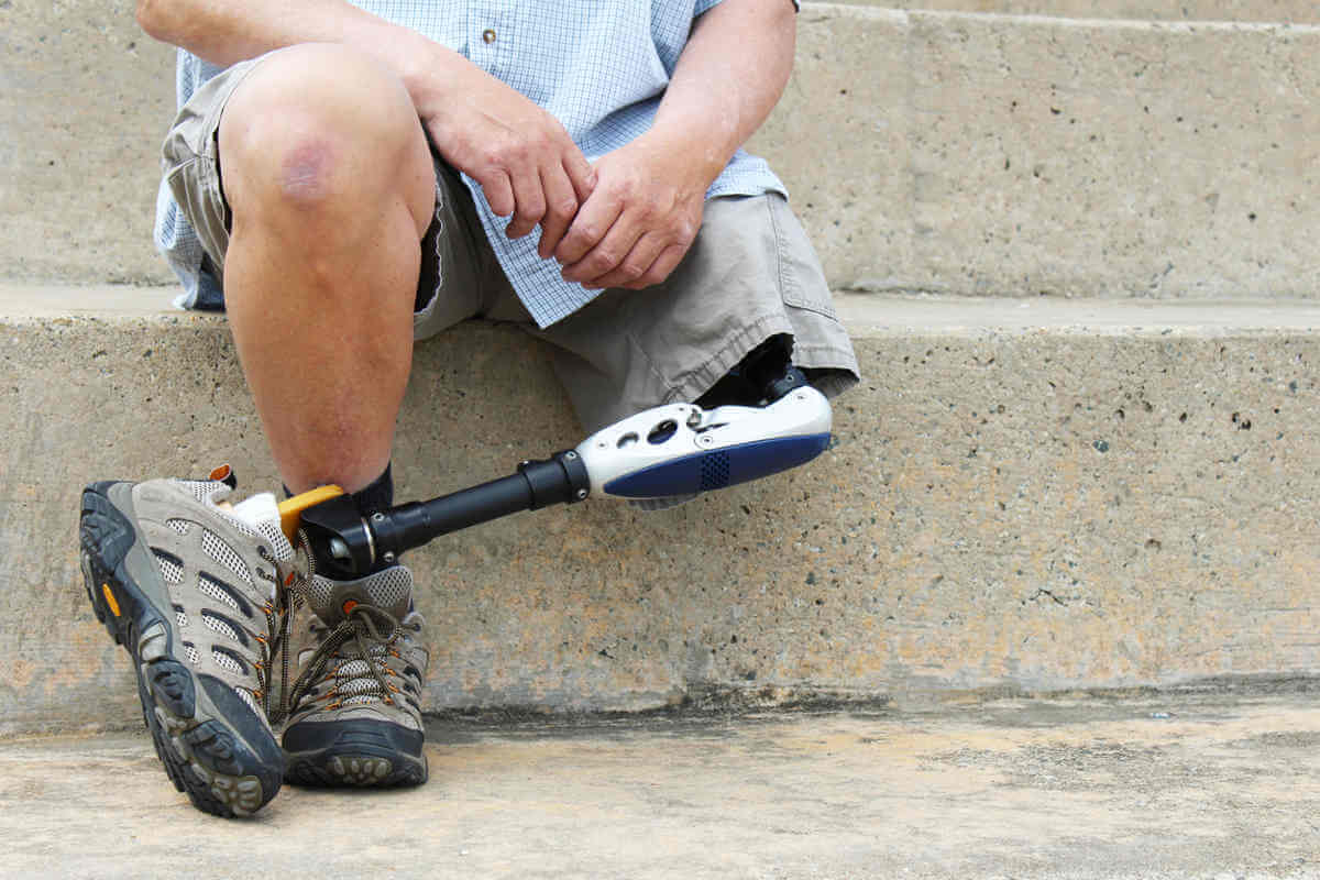 У Львові ветеранам оплачуватимуть протези: місто запустило нову програму