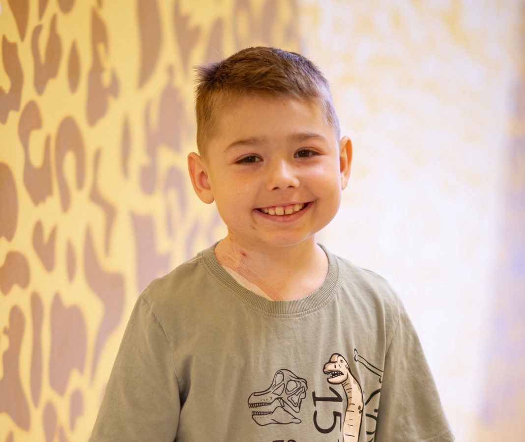 Дитина понад пів року жила без нирок: львівські лікарі провели успішну трансплантацію та зупинили рецидив