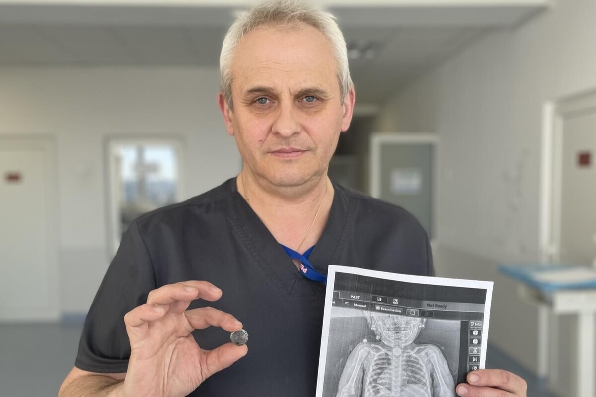Три місяці болю: у дворічної дівчинки в стравоході виявили батарейку
