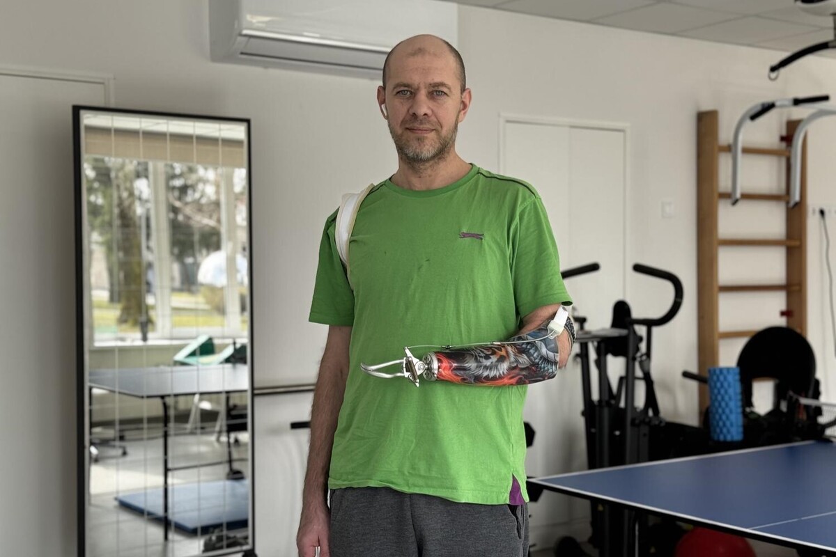 Втратив кінцівку через удар ворожого FPV-дрона: у Львові 41-річному Захисникові встановили біонічний протез руки